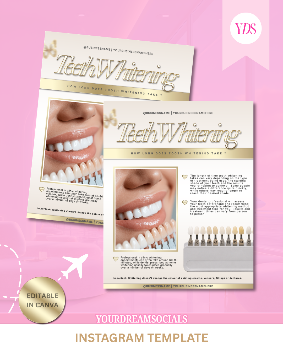Teeth whitening how long does it take template