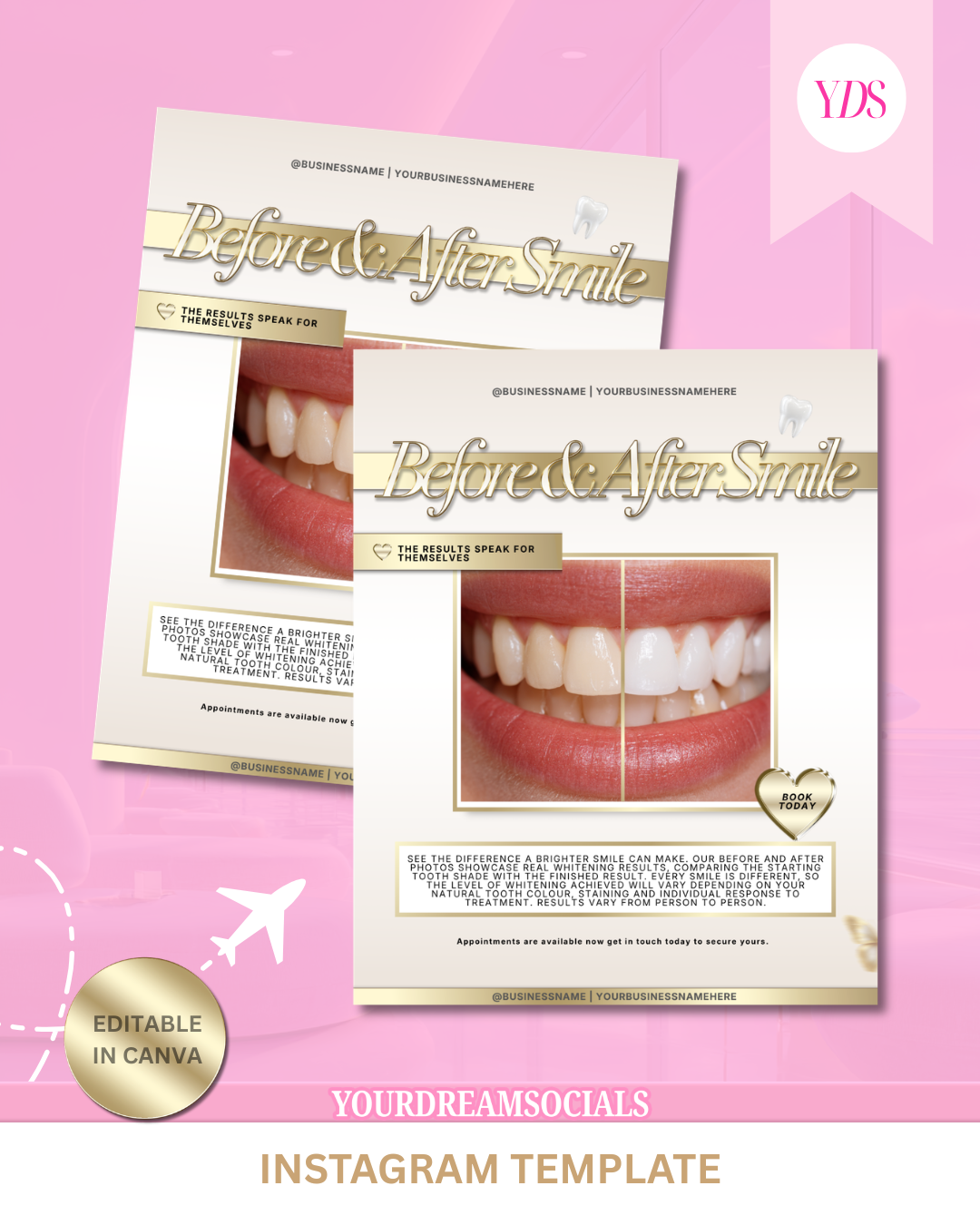 Teeth whitening before & after template
