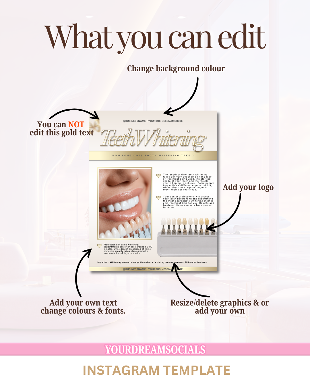 Teeth whitening how long does it take template