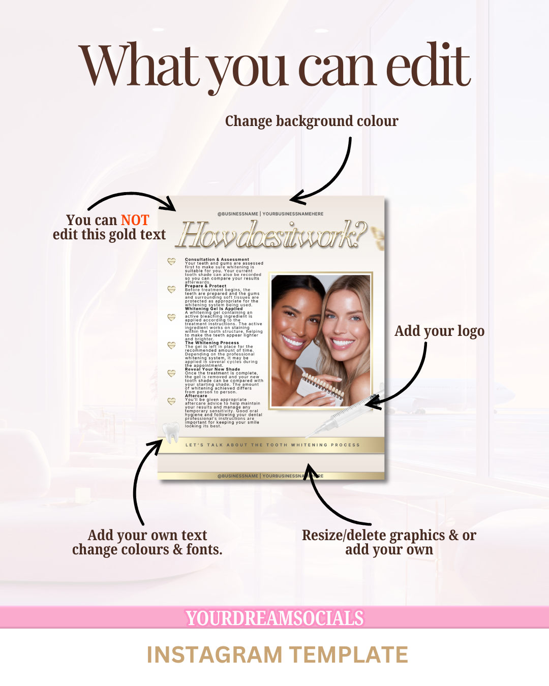 Teeth whitening how it works template