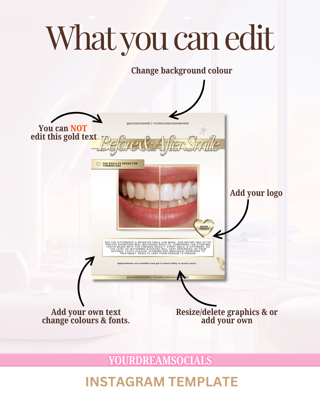 Teeth whitening before & after template