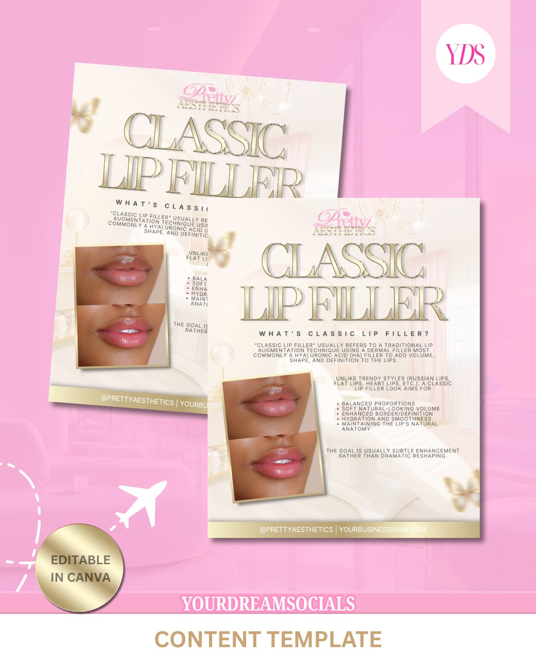 Classic lip filler template