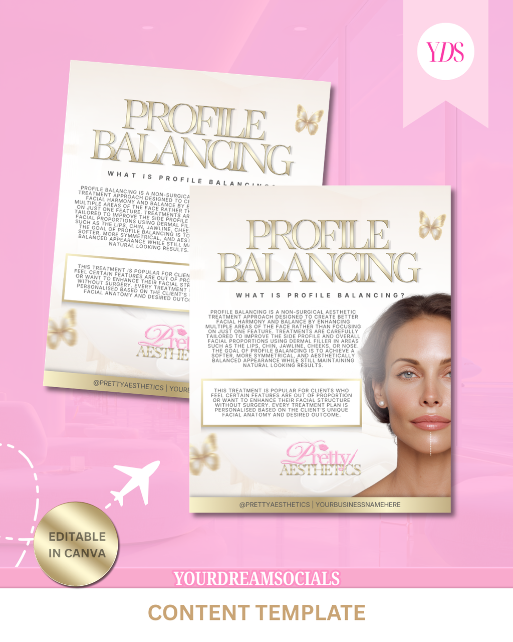 Profile balancing template