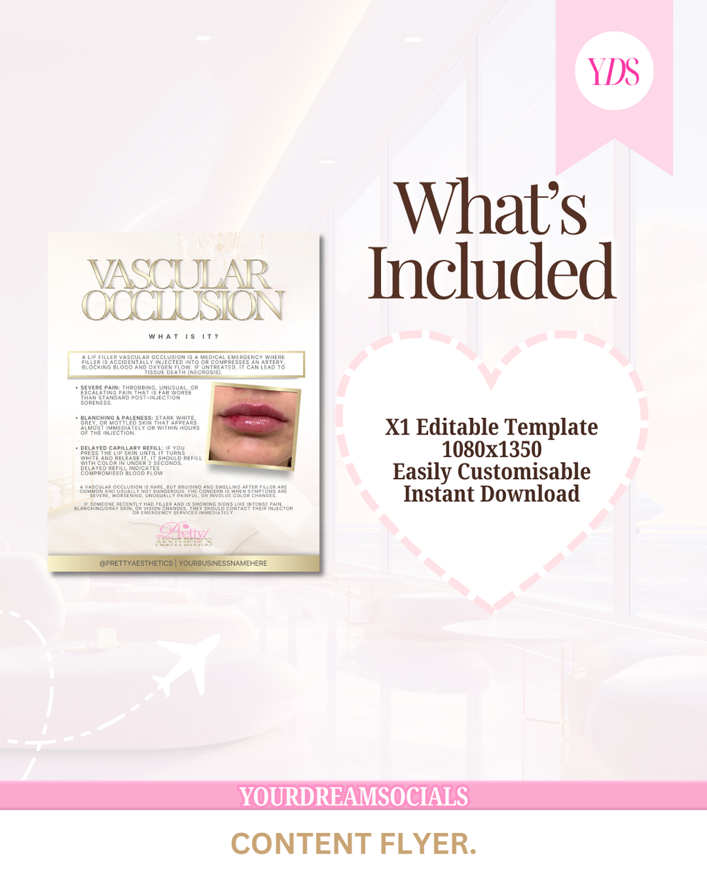 Vascular occlusion template