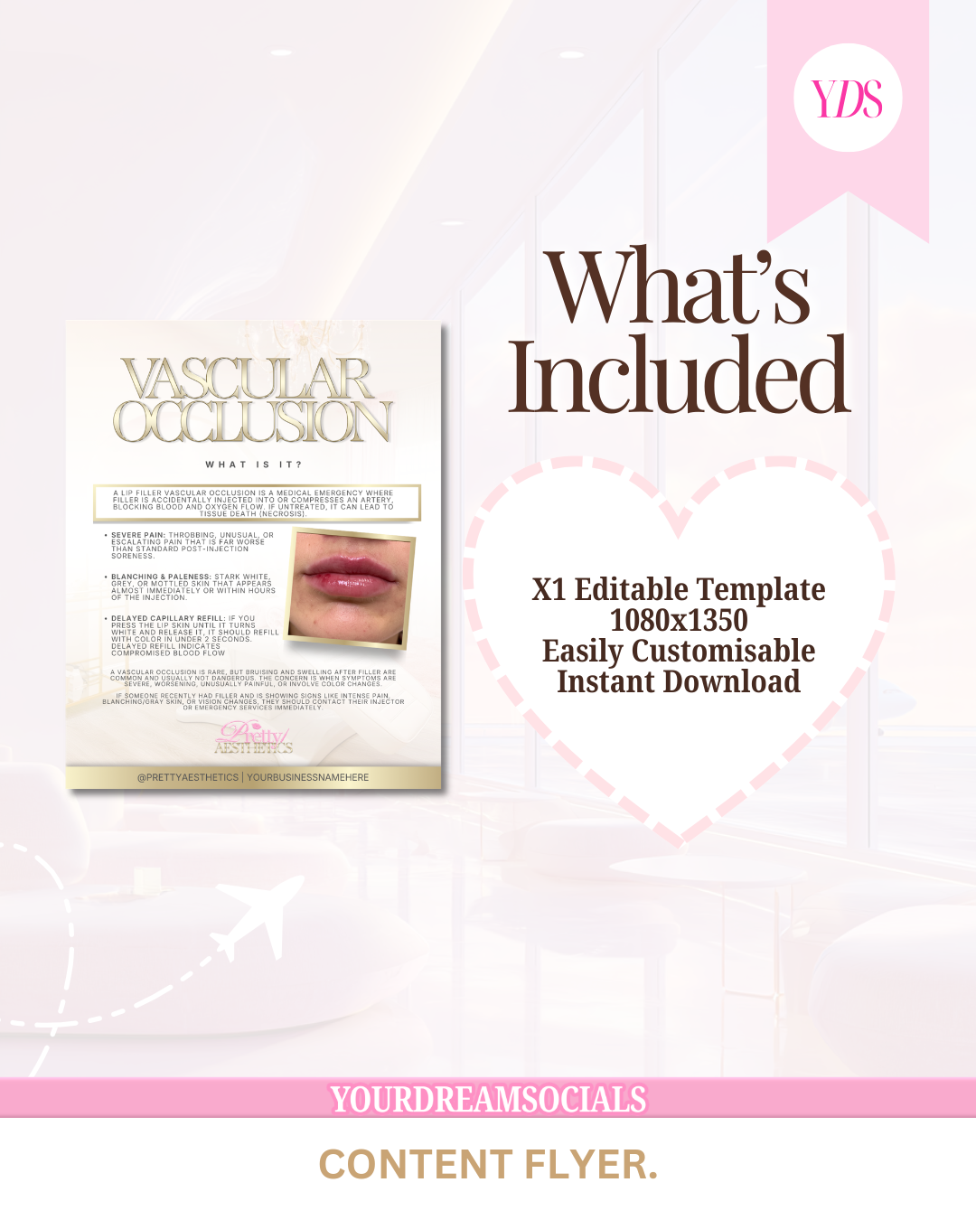 Vascular occlusion template
